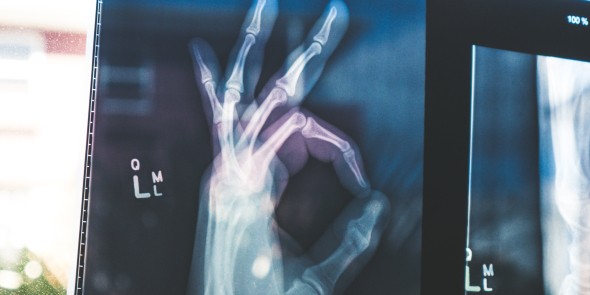 HRscan: pioniers geven grote onderscheiding
